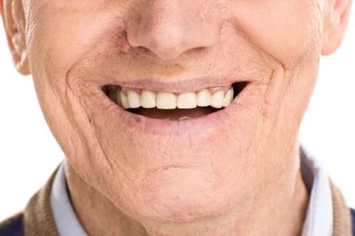 60岁种牙好还是镶牙好，怎么选更合适？